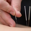 Acupuntura para evitar los partos de riesgo