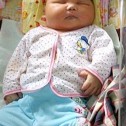 El bebé más grande nace en Indonesia con 8.7 kilos